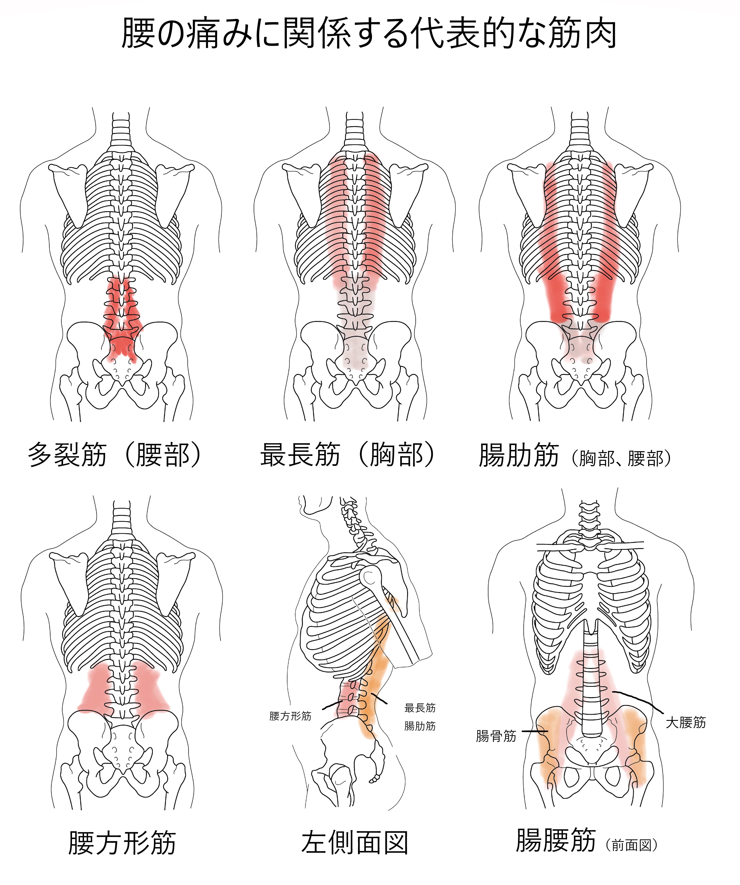 腰痛の原因となりやすい筋肉